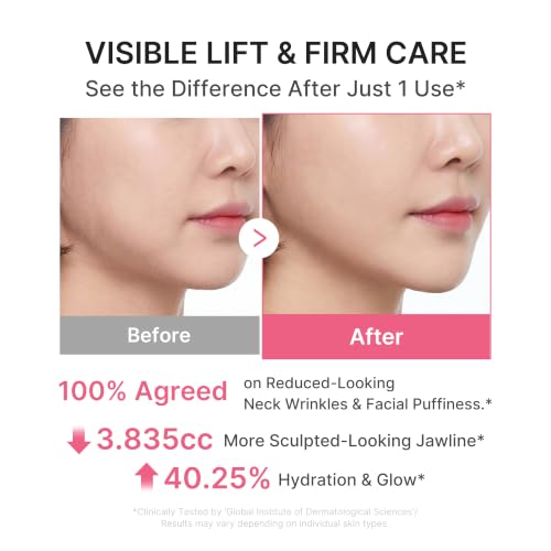 SeoulSculpt™ PDRN Face & Neck Contour Firming Duo - Clinical Before After